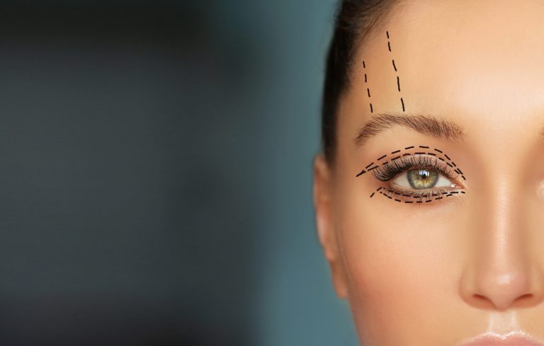 Eyelid Surgery - Lower and Upper Eyelid Procedures