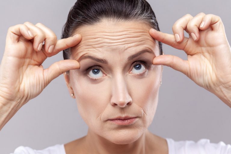 Woman showing lines on forehead for a brow lift procedure image